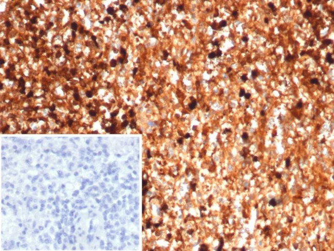 Calprotectin/MRP14/S100A9/Calgranulin B Antibody in Immunohistochemistry (Paraffin) (IHC (P))