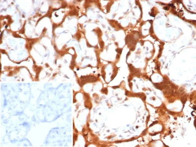 S100A11 (S100 calcium binding protein A11)/Calgizzarin Antibody in Immunohistochemistry (Paraffin) (IHC (P))