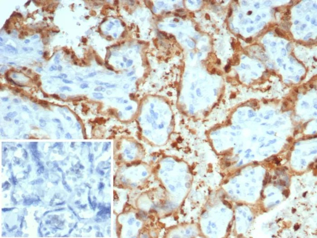 S100A12/CGRP Antibody in Immunohistochemistry (Paraffin) (IHC (P))