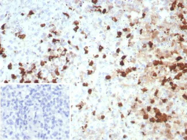 S100A12/CGRP Antibody in Immunohistochemistry (Paraffin) (IHC (P))