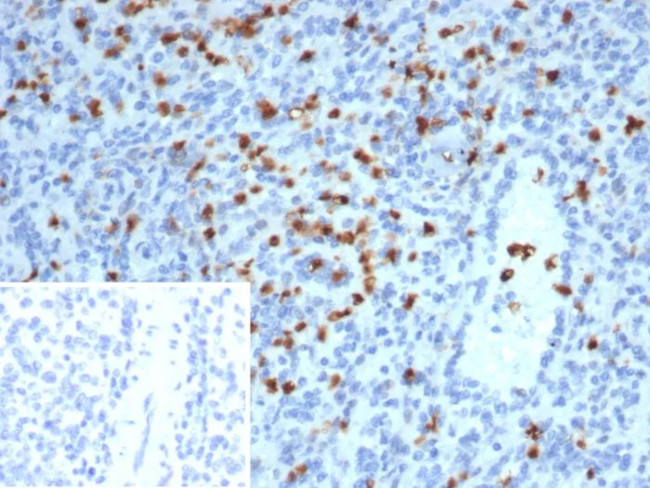 S100A13 (S100 Calcium Binding Protein A13) Antibody in Immunohistochemistry (Paraffin) (IHC (P))