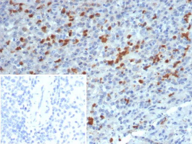 S100A13 (S100 Calcium Binding Protein A13) Antibody in Immunohistochemistry (Paraffin) (IHC (P))