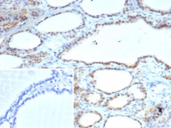 S100A13 (S100 Calcium Binding Protein A13) Antibody in Immunohistochemistry (Paraffin) (IHC (P))