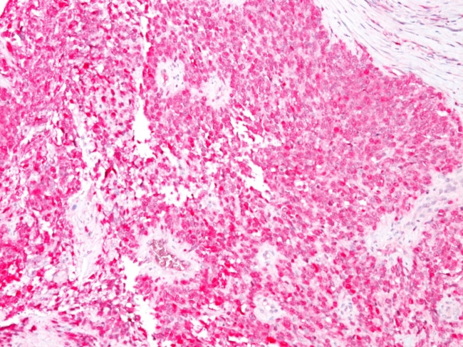 S100B (Astrocyte and Melanoma Marker) Antibody in Immunohistochemistry (Paraffin) (IHC (P))