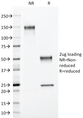 S100B (Astrocyte and Melanoma Marker) Antibody in SDS-PAGE (SDS-PAGE)