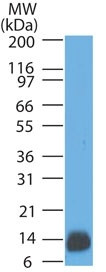 S100B (Astrocyte and Melanoma Marker) Antibody in Western Blot (WB)