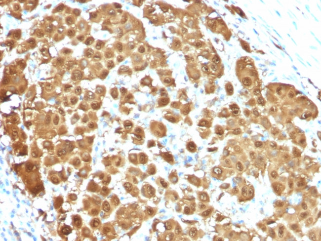 S100B (Astrocyte and Melanoma Marker) Antibody in Immunohistochemistry (Paraffin) (IHC (P))