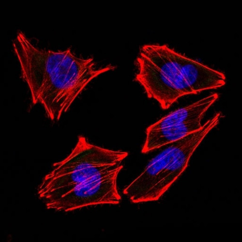 S100B (Astrocyte and Melanoma Marker) Antibody in Immunocytochemistry (ICC/IF)