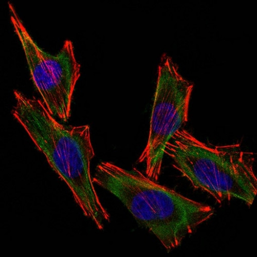 S100B (Astrocyte and Melanoma Marker) Antibody in Immunocytochemistry (ICC/IF)