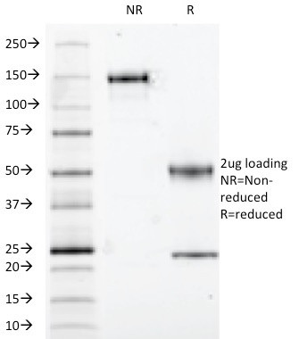 S100B (Astrocyte and Melanoma Marker) Antibody in SDS-PAGE (SDS-PAGE)