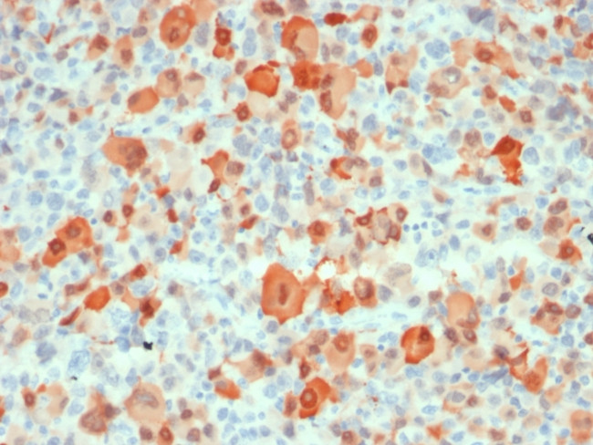 S100B Antibody in Immunohistochemistry (Paraffin) (IHC (P))