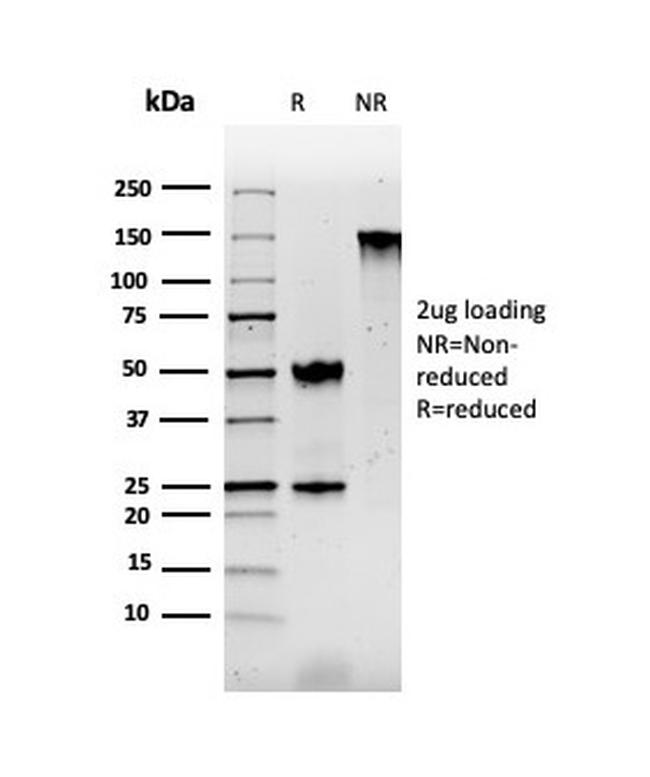 S100B Antibody in SDS-PAGE (SDS-PAGE)