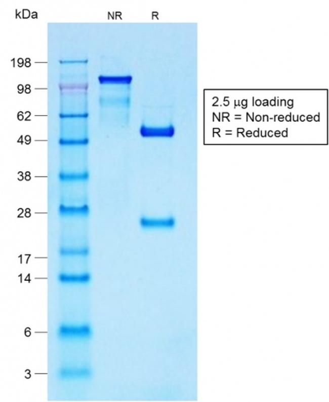 S100B Antibody in SDS-PAGE (SDS-PAGE)