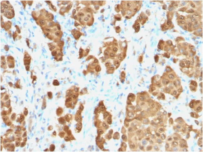 S100B Antibody in Immunohistochemistry (Paraffin) (IHC (P))