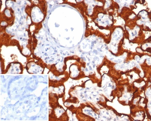 S100P/MIG9 Antibody in Immunohistochemistry (Paraffin) (IHC (P))