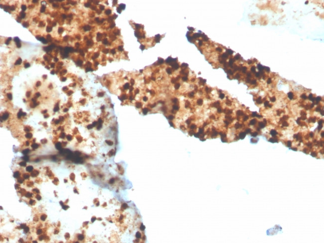 S100P Antibody in Immunohistochemistry (Paraffin) (IHC (P))