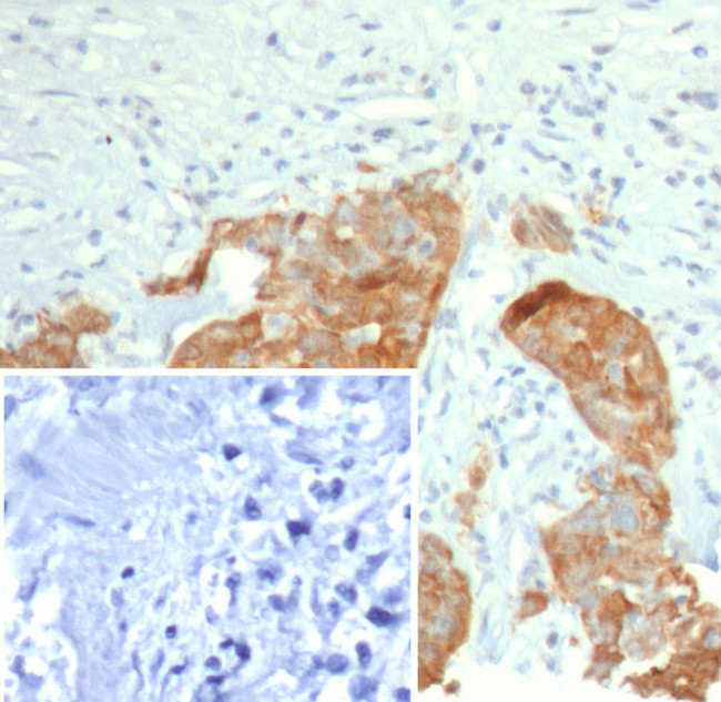 S100P/MIG9 Antibody in Immunohistochemistry (Paraffin) (IHC (P))