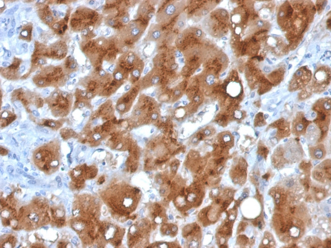 Serum Amyloid A Antibody in Immunohistochemistry (Paraffin) (IHC (P))