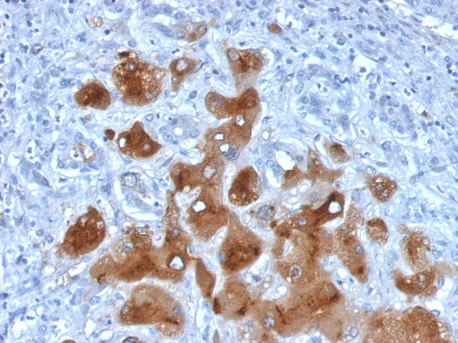 Serum Amyloid A Antibody in Immunohistochemistry (Paraffin) (IHC (P))