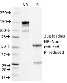 Serum Amyloid A Antibody in SDS-PAGE (SDS-PAGE)