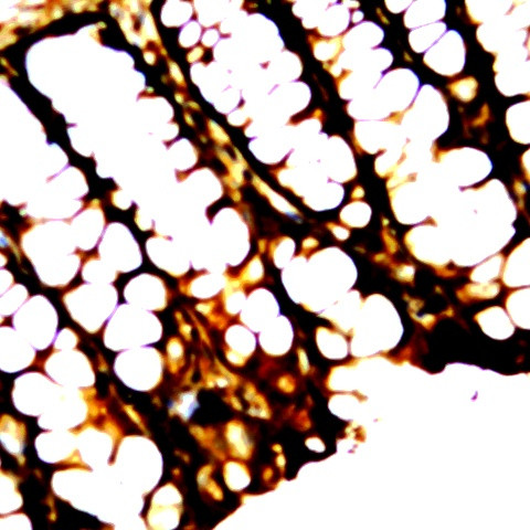 ZO-2 Antibody in Immunohistochemistry (Paraffin) (IHC (P))