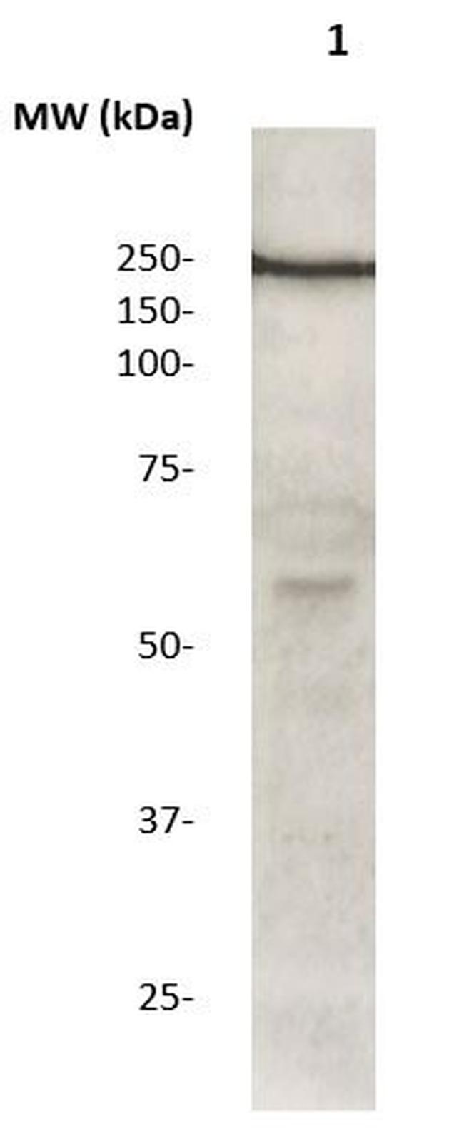 LRRK2 Antibody in Western Blot (WB)