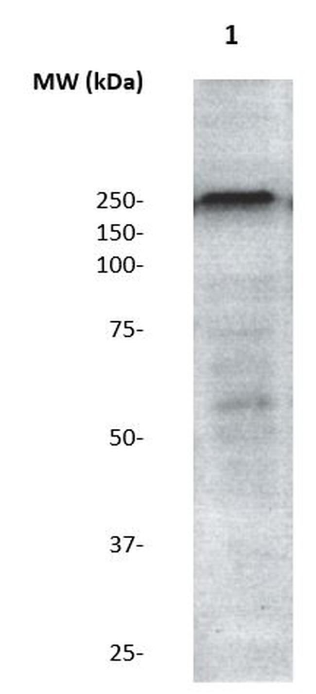 LRRK2 Antibody in Western Blot (WB)