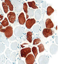 Dystrophin Antibody in Immunohistochemistry (Paraffin) (IHC (P))