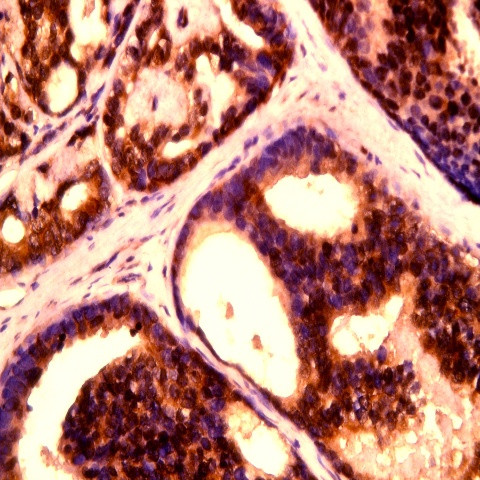 Phospho-L1CAM (Ser1152) Antibody in Immunohistochemistry (Paraffin) (IHC (P))