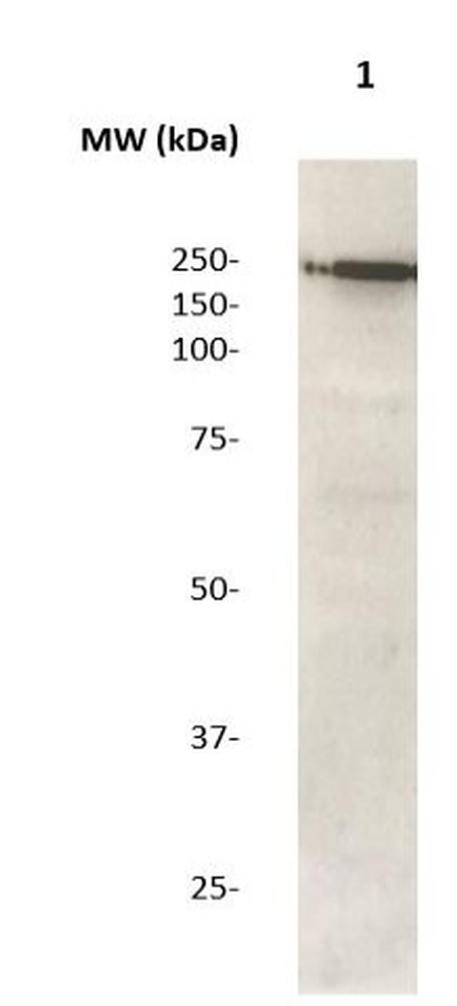 LRRK2 Antibody in Western Blot (WB)