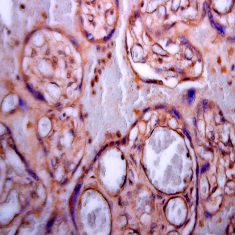 TGFBR1 Antibody in Immunohistochemistry (Paraffin) (IHC (P))