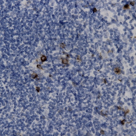 CRTC-3 Antibody in Immunohistochemistry (Paraffin) (IHC (P))