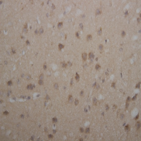 Parkin Antibody in Immunohistochemistry (Paraffin) (IHC (P))