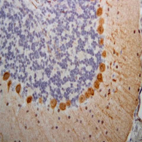 Phospho-PINK1 (Thr257) Antibody in Immunohistochemistry (Paraffin) (IHC (P))