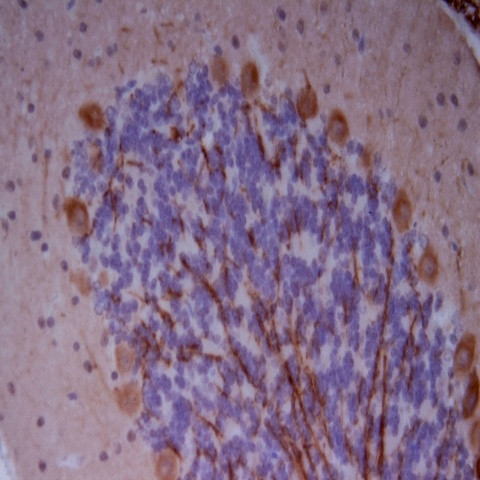 PINK1 Antibody in Immunohistochemistry (Paraffin) (IHC (P))