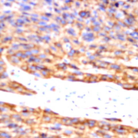 SH3BP5 Antibody in Immunohistochemistry (Paraffin) (IHC (P))