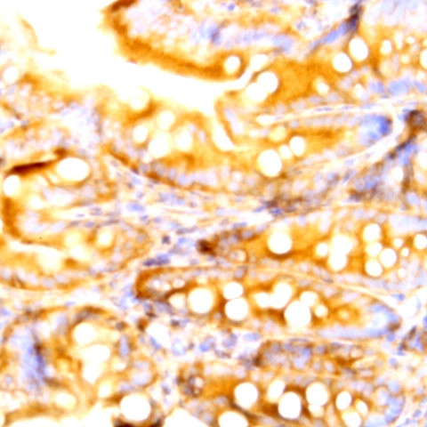 DLL4 Antibody in Immunohistochemistry (Paraffin) (IHC (P))