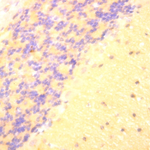 KCNA3 Antibody in Immunohistochemistry (Paraffin) (IHC (P))