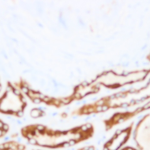 Neuropilin-1 Antibody in Immunohistochemistry (Paraffin) (IHC (P))