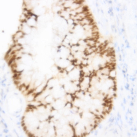 SirT3 Antibody in Immunohistochemistry (Paraffin) (IHC (P))