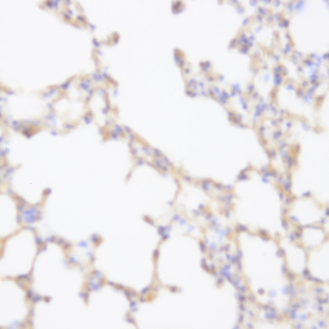ALDH1a1 Antibody in Immunohistochemistry (Paraffin) (IHC (P))