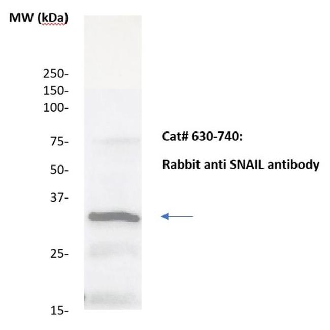 SNAIL-1, 2, 3 Antibody in Western Blot (WB)