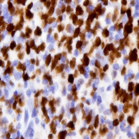 TWIST1/2 Antibody in Immunocytochemistry (ICC/IF)