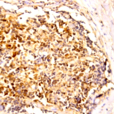 STAP1 Antibody in Immunohistochemistry (Paraffin) (IHC (P))