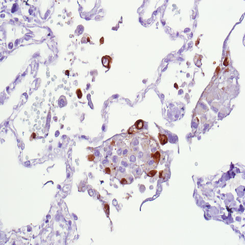 SARS-CoV2 (S2) Antibody in Immunohistochemistry (Paraffin) (IHC (P))