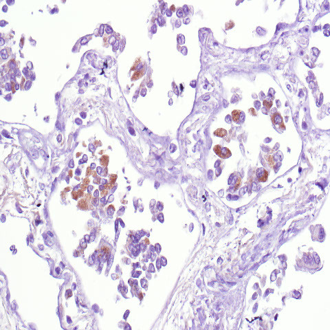 SARS-CoV2 (N1) Antibody in Immunohistochemistry (Paraffin) (IHC (P))