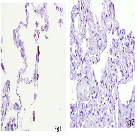 SARS-CoV2 (N2) Antibody in Immunohistochemistry (Paraffin) (IHC (P))