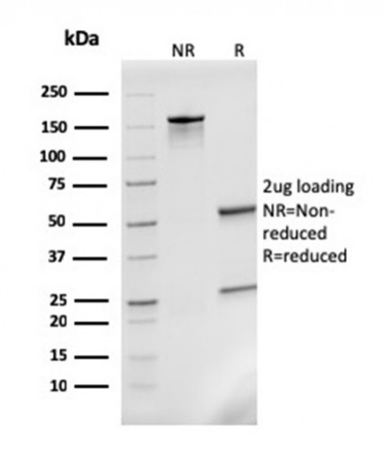 Monocyte Chemotactic Protein 2 (MCP2)/CCL8 Antibody in SDS-PAGE (SDS-PAGE)