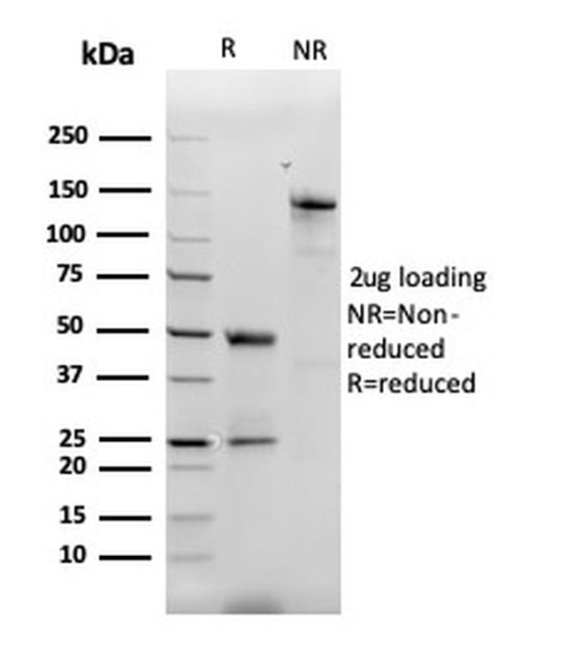 Monocyte Chemotactic Protein 2 (MCP2)/CCL8 Antibody in Immunoelectrophoresis (IE)