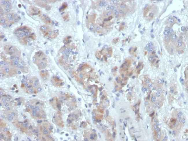 CCL18/C-C motif chemokine ligand 18 Antibody in Immunohistochemistry (Paraffin) (IHC (P))